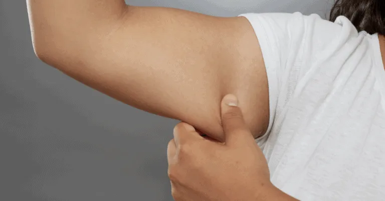 7 Proven Ways To Melt Away Arm Fat